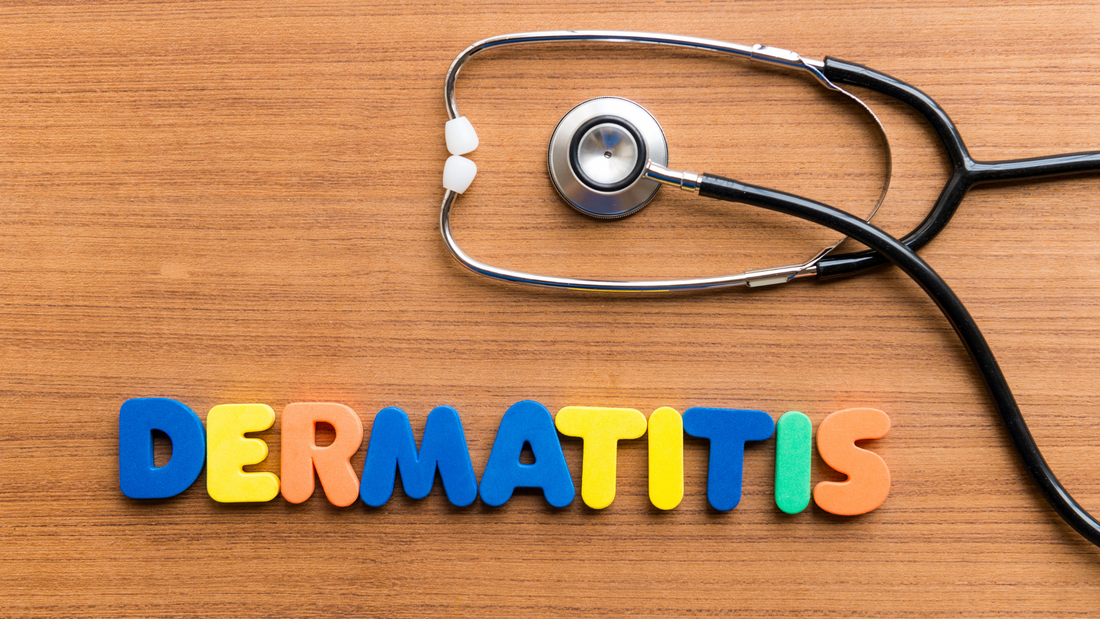 Borite se s dermatitisom, nudimo vam alternativna rješenja